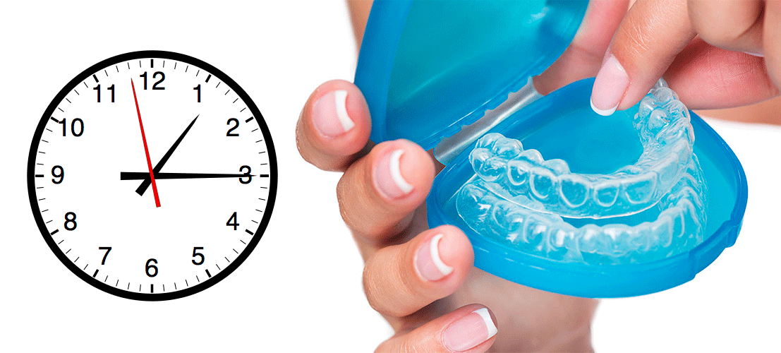 How Long Should You Wear Your Aligners Each Day?"
